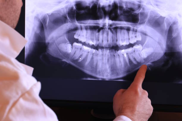 Best Weekend Emergency Dentist in Humansville, MO